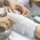 Essential Qualities to Seek in Legal Representation for Burn Injuries
