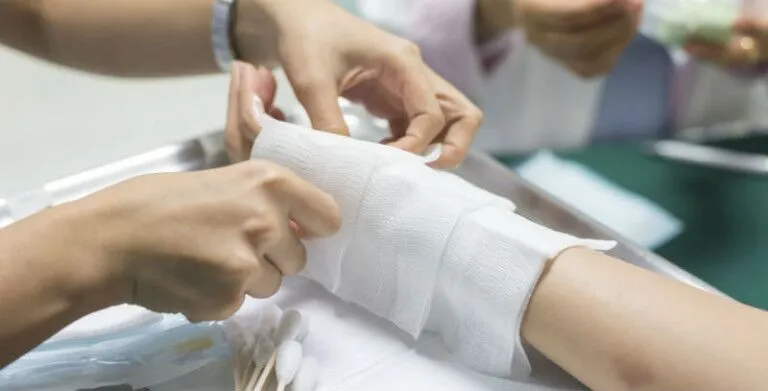 Essential Qualities to Seek in Legal Representation for Burn Injuries